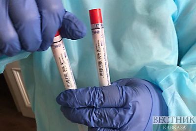 Иран начнет экспортировать тест-системы для коронавируса