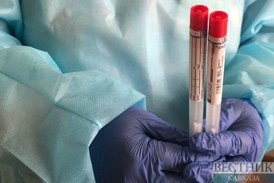 Российский тест антител к коронавирусу назван одним из лучших в мире